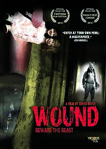 Wound